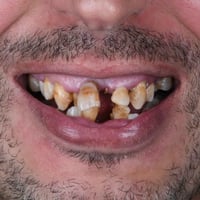 مركز اسد التخصصي • ابتسامة • المدائن شارع الاطباء