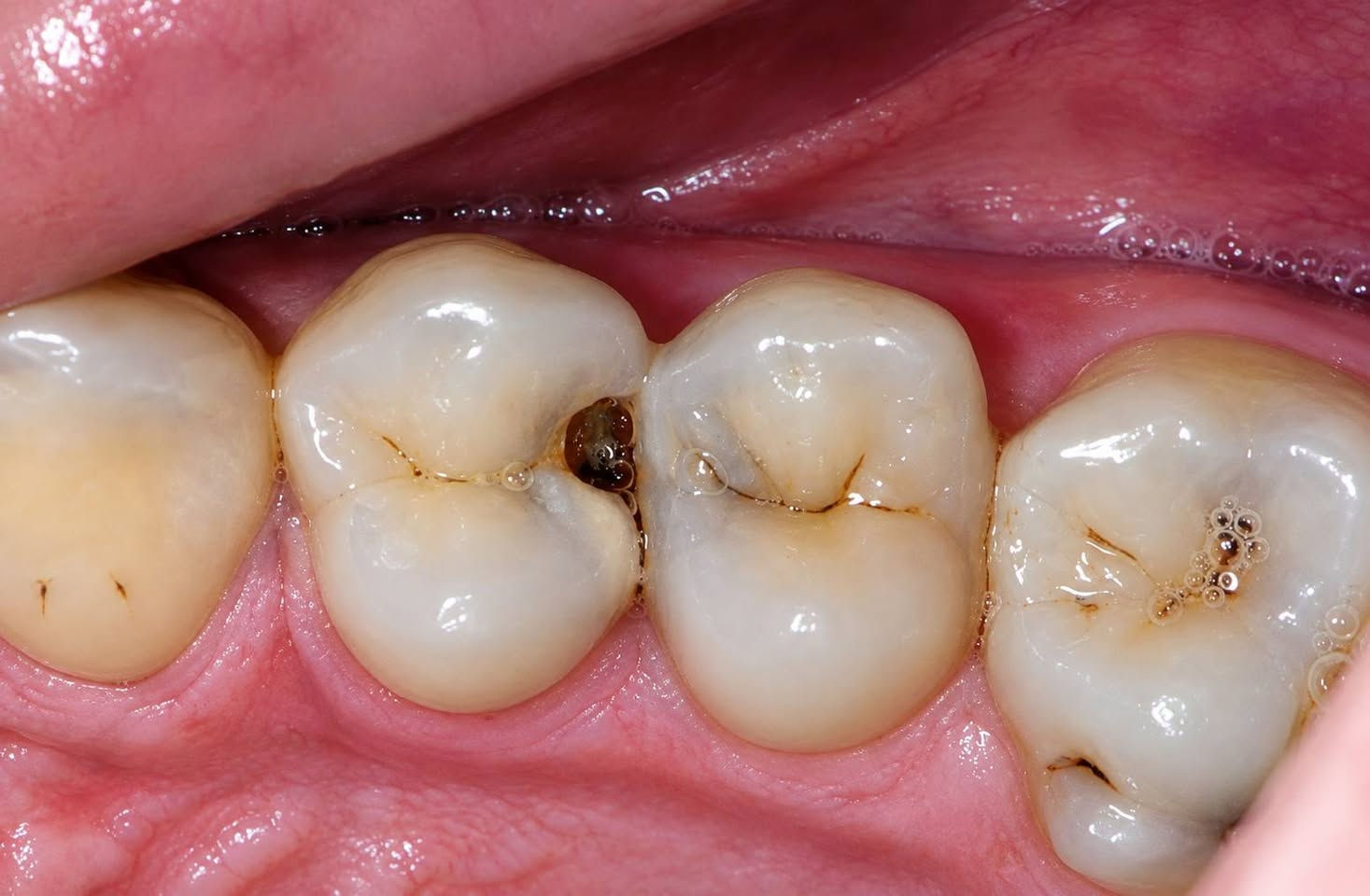 🦷 العلاج مجاني للحالات
بإشراف نخبة من الأطباء المختصين وذوي الخبرة والكفاءة، لضمان تقديم رعاية وعلاج بمستوى مهني مميز. 🤍
📍 عيادات بيارق العميد – السعدية، خلف مول الحارث
📩 للتواصل: خاص أو واتساب
📱 ***********

نص مكتوب في الصور:
- الدكتوره زهراء كريم العلاج مجاني للحالات بإشراف نخبة من الأطباء المختصين وذوي الخبرة والكفاءة، لضمان تقديم رعاية وعلاج بمستوى مهني مميز. ابتسامتك .. تستحق الأفضل قلع الاسنان والجذور المتبقيه الحشوات الضوئيه التجميليه تنظيف الأسنان من التكلسا ت وتلميعها تعويض الأسنان المفقوده بالتراكيب السنيه المتحركه عيادات بيارق العميد السعدية - خلف مول الحارث *********** للتواصل: خاص أو واتساب
- DR. AMJAD ALQAYYUM DENTAL CLINIC