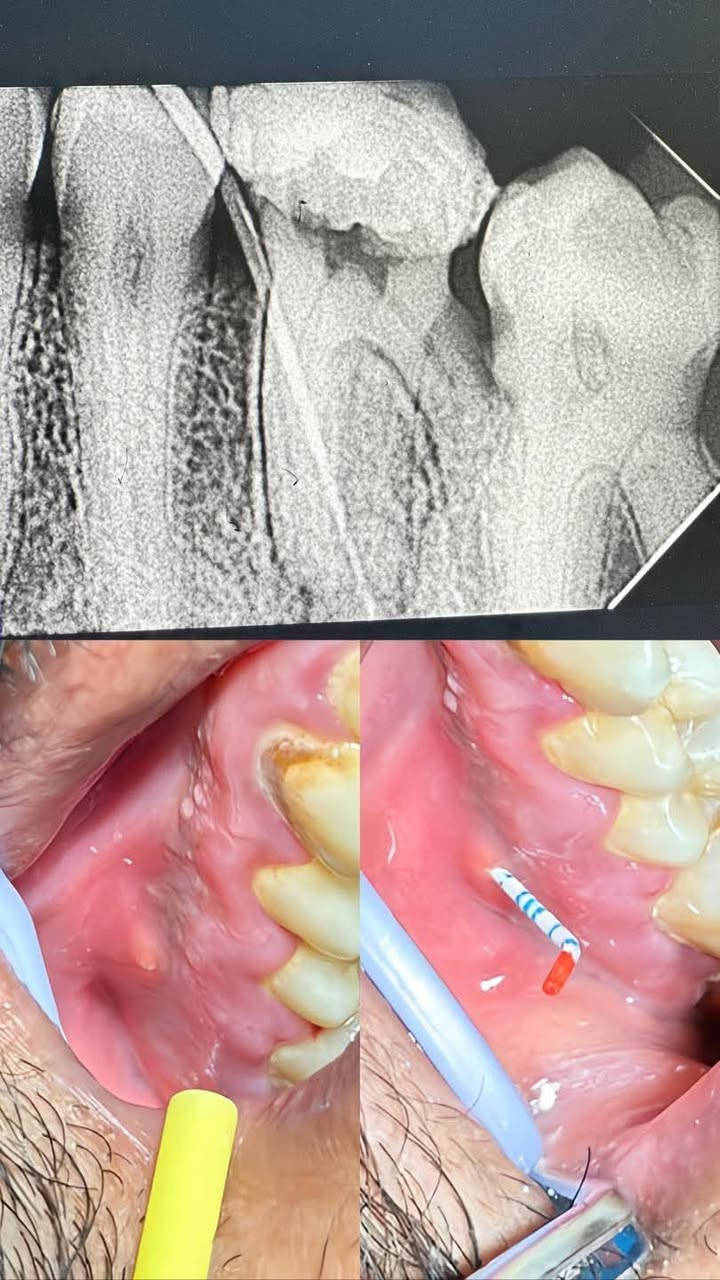 مجمع اهلنا النموذجي الطبي 
عيادة أونو 
لطب تجميل الأسنان 
بتواجد 
الدكتور محمد رحم الحجامي 
والدكتور احمد الصافي 
العنوان خلف سيد جعفر 
نهاية شارع الصناعي 
الديوانية قضاء البدير 
للحجز والاستفسار 
***********
