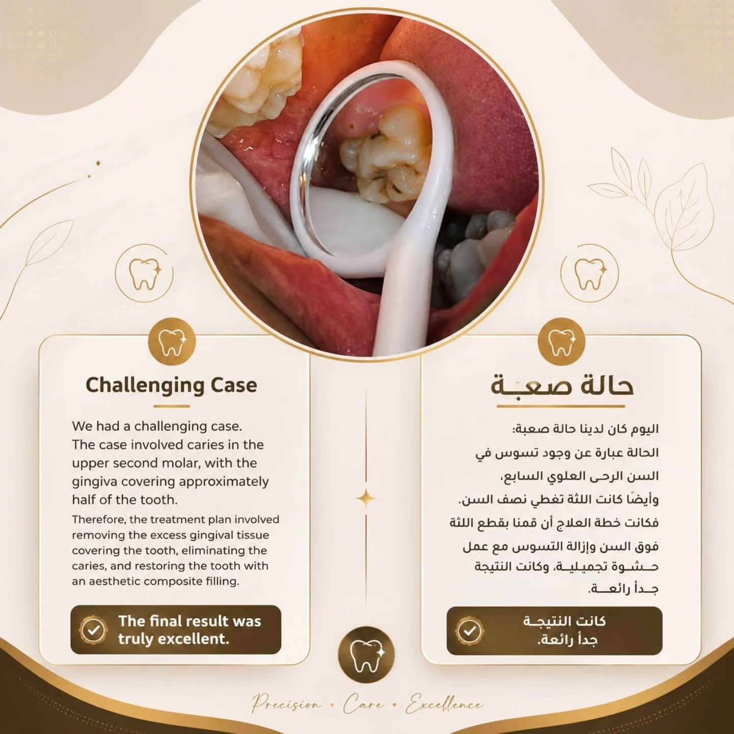 رقم الحجز :***********
علما ان العلاج ب أسعار رمزية جدااا🔥🔥

