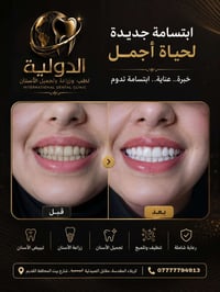 زراعة أسنان • طب أسنان • كربلاء