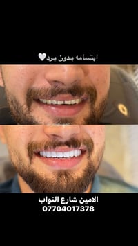 صالون تجميل • الامين شارع النواب • ابتسامه بدون برد