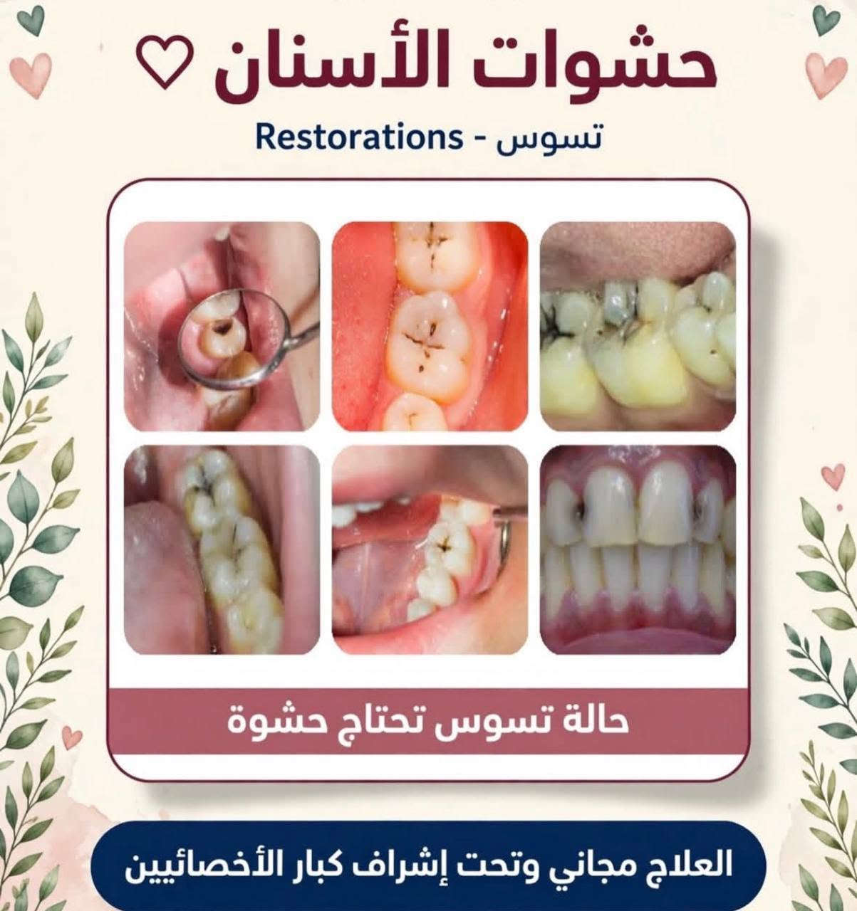 علاج أسنان مجاني • قلع أسنان • كربلاء حي النقيب