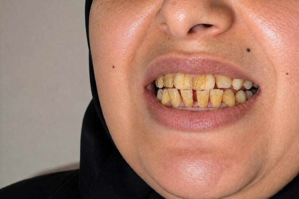 "لا تكتمل أناقتك إلا بأسنان بيضاء ولامعة."

متواجدين لخدمتكم طيلة أيام الأسبوع #الشركة_الطبية_العالمية 
🔻
🏢 العنوان / بغداد _ بسماية _ الشارع العام  . مجاور ماركت الغدير 
فوق مطعم بي تاون
📲 للحجز والاستفسار 
***********
#مركز_بسماية_لطب_وتجميل_الاسنان
