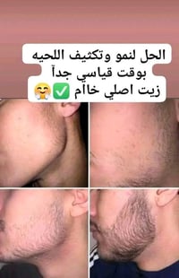💥💥جديدنا 💥💥 زيت لنمو وزيادة كثافة الشعر واللحية يعزز من نمو وكثافة الش...