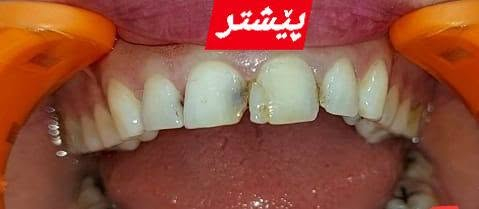 #fyp #foryou نمونەی کارەکانمان#چوارقوڕنە دوسایدی گۆڕان تەلاری نور بەرامبەر ساردەمەنی قەرەسەد ☎️***********
