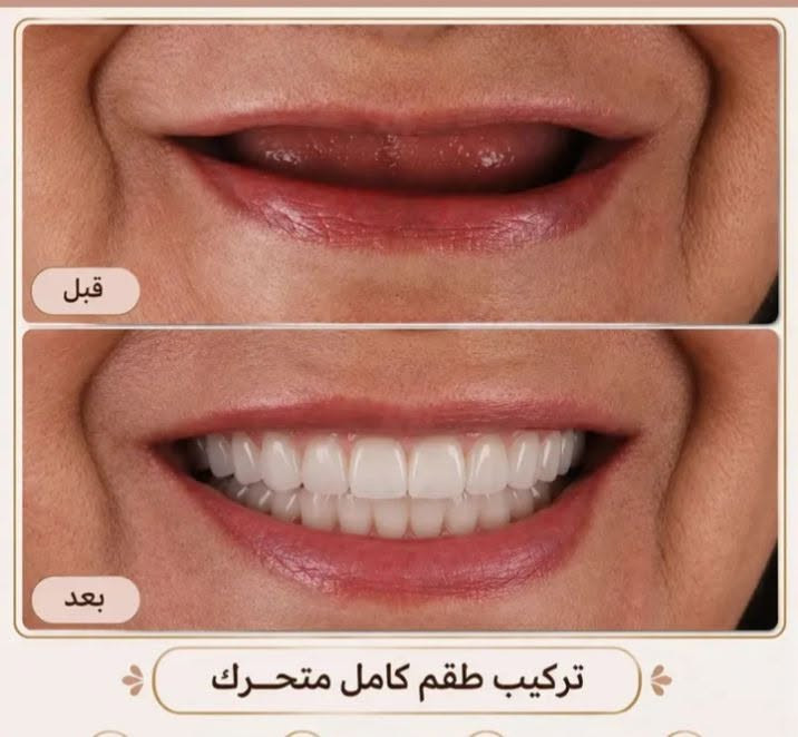 عيادات الجامعة الوطنية • خدمات مجانية • قلع أسنان