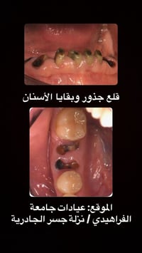 مجاني • قلع جذور • حجز مباشر