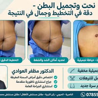 مضفر العوادي • جراحة السمنة • نحت البطن
