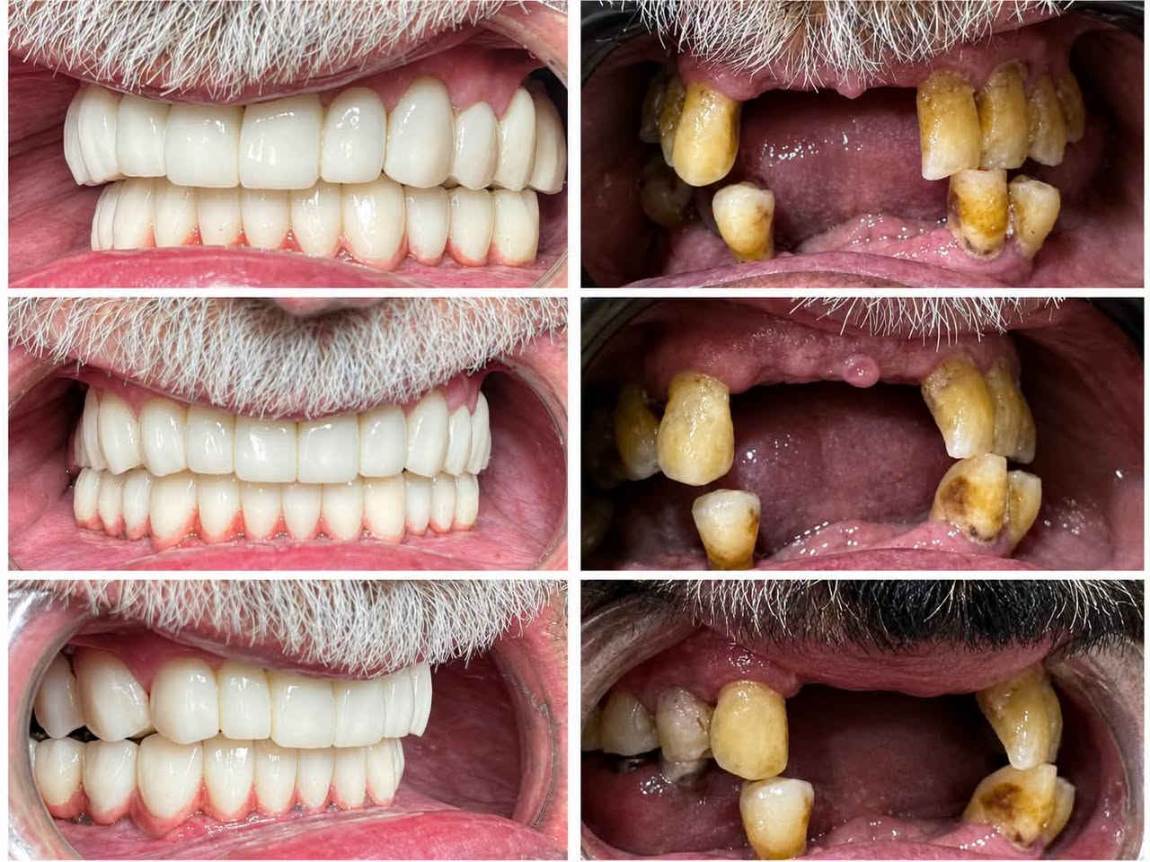 😁✨ ابتسامتك يمنا غير!

خلّي ابتسامتك تحچي عنك 🤍
عناية متخصصة وابتسامة تليق بملامحك مع كادر قسم الأسنان 🦷✨

📍 الموقع: واسط – العزيزية – شارع الخليج – جانب البوابة
📞 للحجز والاستفسار: ***********

🏥 مستشفى روح الحياة الأهلي
🦷 قسم الأسنان
