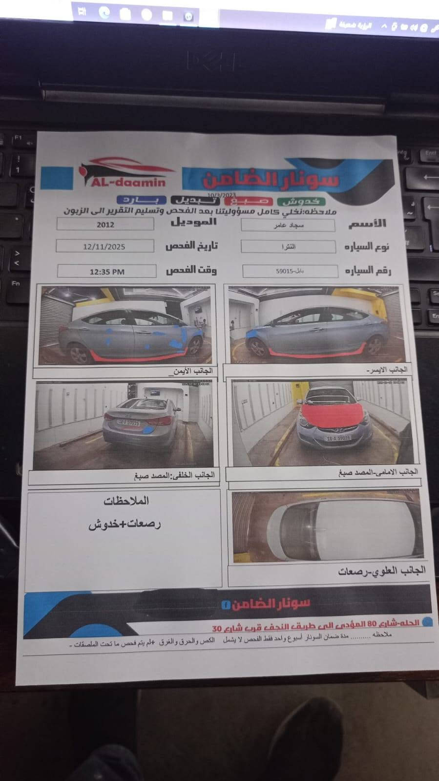 النترا 2012 أمريكي رقم بابل ضرر بنيد ومعمري بدون دواخل وسونارها موجود بلمنشور سنويه بسمي كير ومكينه وتبريد مكفولات مكاني بابل الاسكندريه سعر 95 وبيها مجال مكينتها 2000 وترايك وين ميعجبك كلشي ماناقصها سيارة حلوة ونضيفه ***********

نص مكتوب في الصور:
- سونار الضامن AL-daamin 10/3/2023 خدوش صبغ تبديل بارد ملاحظه:نخلي كامل مسؤوليتنا بعد الفحص وتسليم التقرير الى الزبون الأسم سجاد عامر الموديل 2012 نوع السيارة النترا تاريخ الفحص 12/11/2025 رقم السيارة بابل-59015 وقت الفحص 12:35 PM الجانب الأيمن الجانب الأيسر الجانب الخلفي:المصد صبغ الجانب الامامي-المصد صبغ الملاحظات رصعات+خدوش الجانب العلوي-رصعات سونار الضامن الحله-شارع 80 المؤدي الى طريق النجف قرب شارع 30 ملاحظه .......... مدة ضمان السونار أسبوع واحد فقط الفحص لا يشمل الكص والحرق والغرق +لم يتم فحص ما تحت الملصقات -