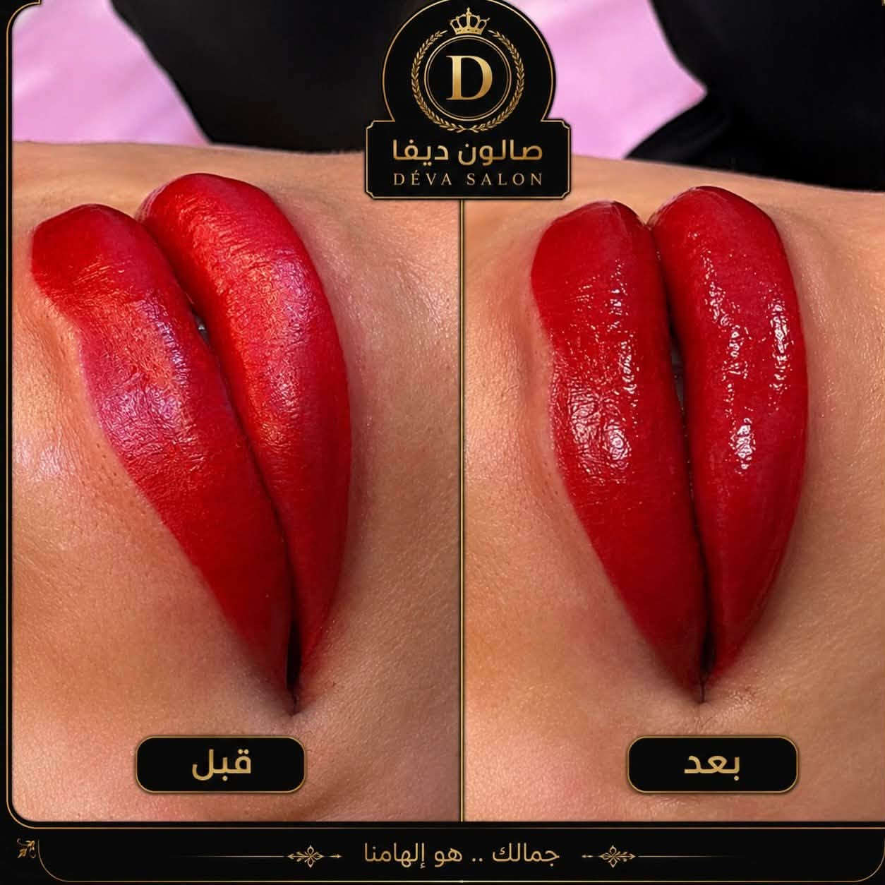 نبأ الشمري

صالون ديفا 🥰🥰
توريد شفه 🍒🍒

سماوه الغربي مقابل متنزه الورده 

***********

https://www.instagram.com/diva_saloon_h.smawa?igsh=dTEyYm1xc2lianJ0
