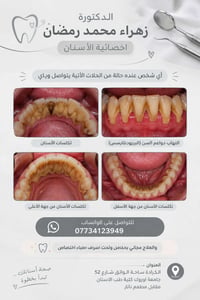 علاج مجاني • تكلسات الأسنان • الكرادة ساحة الواثق