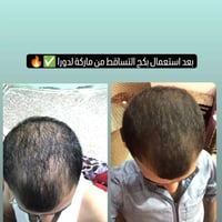 عناية بالبشرة • منتجات إيرانية • استشارة مجانية