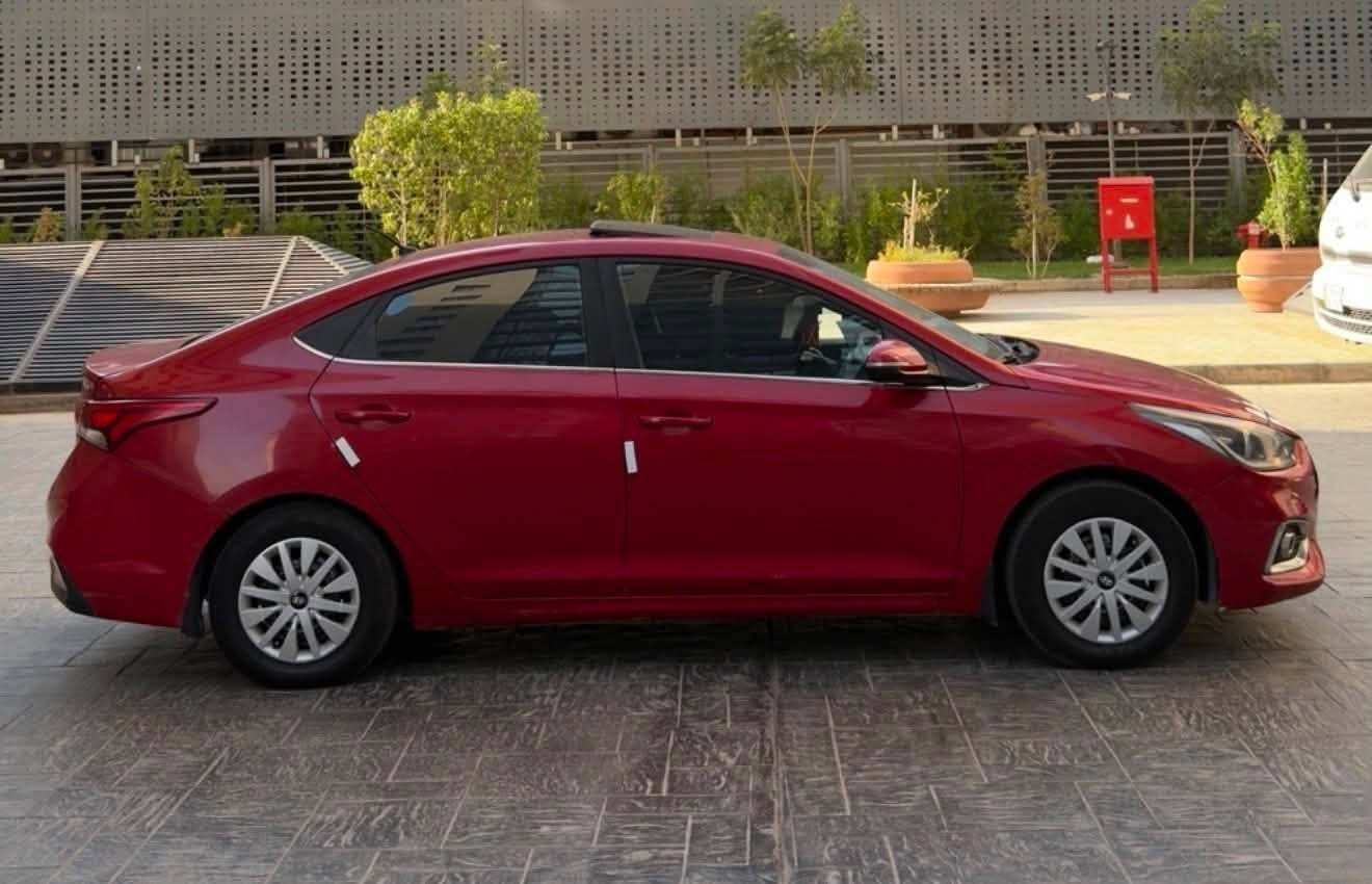Hyundai Accent
للبيع
موديل 2020
خليجي
محرك 1600 دوش
at كير
فول السياره
فتحه سقف
شاشه كامره
نحكم ستيرن فول
مري شفط
لايت دوار
قطعتين تبريد
داخل لونين اسود بيجي
مكينه كفاله
كير كفاله
((بيه صبغ بنيد ودعاميات فقط))
رقم جديد بسمي شرط تحويل
مكان السياره بغداد حي الحسين

السعر (106) بيه مجال بسيط متوازي على بيعتها 

*********** للاستفسار
ممتواجد على الفيس
