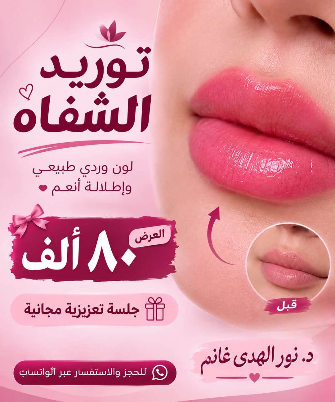 عروضنا لفترة محدودة 
الدكتورة نور الهدى غانم 
للحجز ***********

نص مكتوب في الصور:
- الدكتورة نور الهدى غانم Dr. Noor Al huda Ghanem جمال طبيعي .. بثقة تدوم آخر أسبوع لعروضنا المميزة! لا تفوتون آخر فرصة للاستفادة من عروضنا فلر واحد سي سي + نظارة مجانية نظارة ب 50 ألف الإبرة الوردية ب 75 ألف إبرة العنبر ب 75 ألف الديرما بن ب 50 ألف فلر 3 سي سي + الرابع مجاناً تغيير شامل ب 350 ألف فقط آخر أسبوع للعروض! احجزي الآن قبل انتهاء العرض 17 JUL
- الدكتورة نور الهدى غانم عروض الأسبوع فقط 80 ألف إبرة الرفثال 140 ألف لب بوستر 140 ألف سكن بوستر 140 ألف بوستر تقعر العين 60 ألف توريد الشفة العروض لمدة أسبوع فقط
- عروض حصرية لفترة محدودة! CLINIC سعر الجلسة: ١٠٠ ألف دينار فقط (علامات التمدد/السترتش مارك) جلسات فعالة لتحسين مظهر البشرة علاج علامات التمدد القديمة والجديدة تقنية المايكرونيدل الاحترافية نتائج ملحوظة بعد عدة جلسات *********** الديوانية
- توريد الشفاه لون وردي طبيعي وإطلالة أنعم العرض 80 ألف جلسة تعزيزية مجانية قبل د. نور الهدى غانم للحجز والاستفسار عبر الواتساب