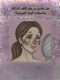 نيبروسين • كلف • تصبغات هرمونية