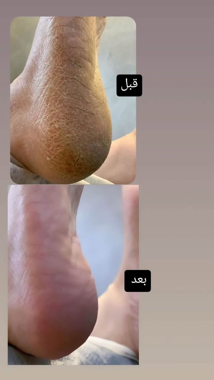 جلسات بدكير يمنه غير شي

شوفولي لعروض بنات مسابقاتنه راح تستمر تفاعلكم بمشاركةً منشوراتنه بكروبات سماوةً اكثر وحدة تتفاعل راح تفوز ويانه بجائزة حلوة

صالون نيولوك

عنوان غربي ثاني شارع حجي سليمان  بصف الجامع عمارة بيضة دخلي بفرع العمارة 

 *********** مفتوح الصالوون يوميا من  ٩ صباحا الى ٨ مساء.
