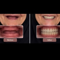 علاج مجاني • طقم أسنان كامل • بيارق جامعة العميد