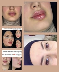 دكتورة حنين الصراف • عيادة تجميل • الكوت شارع الهورة
