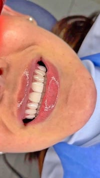 🦷✨ عيادة د. تبارك سليم العباسي لطب وتجميل الأسنان نقدّم لكم رعاية متكا...