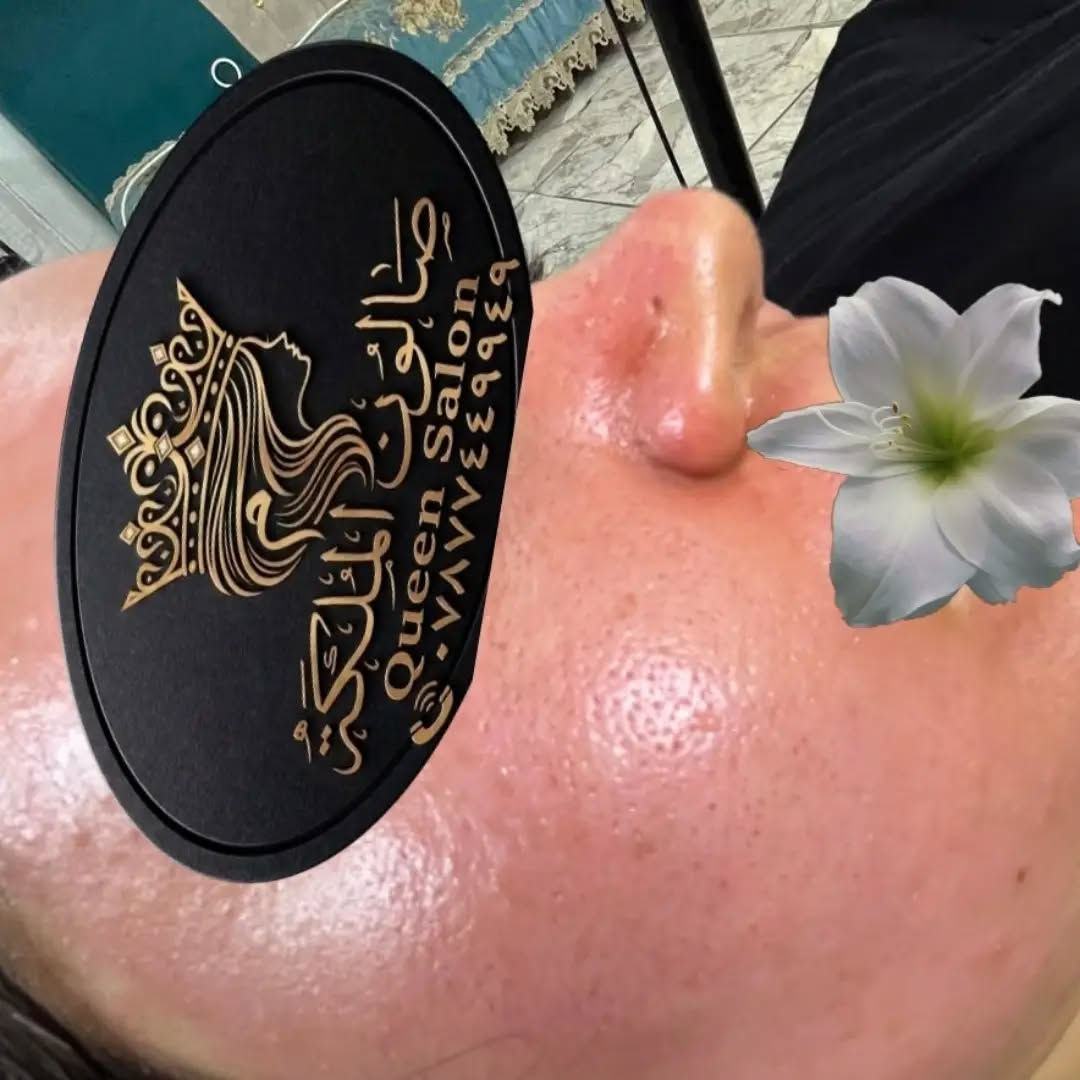 تنضيف بشره مع جلسه ميزو كل هذا ب ١٥ فقط 

ليش البشرة صير حلوة؟بعد جلسه ديرمابن. لان هاي الابر من تدخل للبشرة راح تسوي خدوش مايكروية هاي الخدوش حتئ طيب وتتعافئ راح تحفز أفراز الكولاجين. والايلاستين بالتالي النضارة والشد وتجديد البشرة ❤️

وهاي نتيجه بعد الجلسه♥️ 

للحجز :- ***********
ألعنوان :- ألمحموديه مجمع القادسيه
#بغداد #محافظات #بشره #بشره_صحيه

نص مكتوب في الصور:
- صالون الملكية Queen Salon ***********
- صالون الملكة
- Queen Salon
- ***********٧٨٧٧٤٤٩٩٤٩