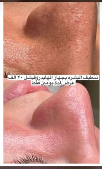 البياع تقاطع الشرطه الرابعه يم مطعم السديل 07765219099  نص مكتوب في ال...