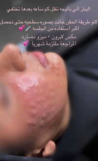 المسيب • عروض • جلسات فري