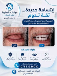 أطقم أسنان • طقم متحرك • حي النقيب