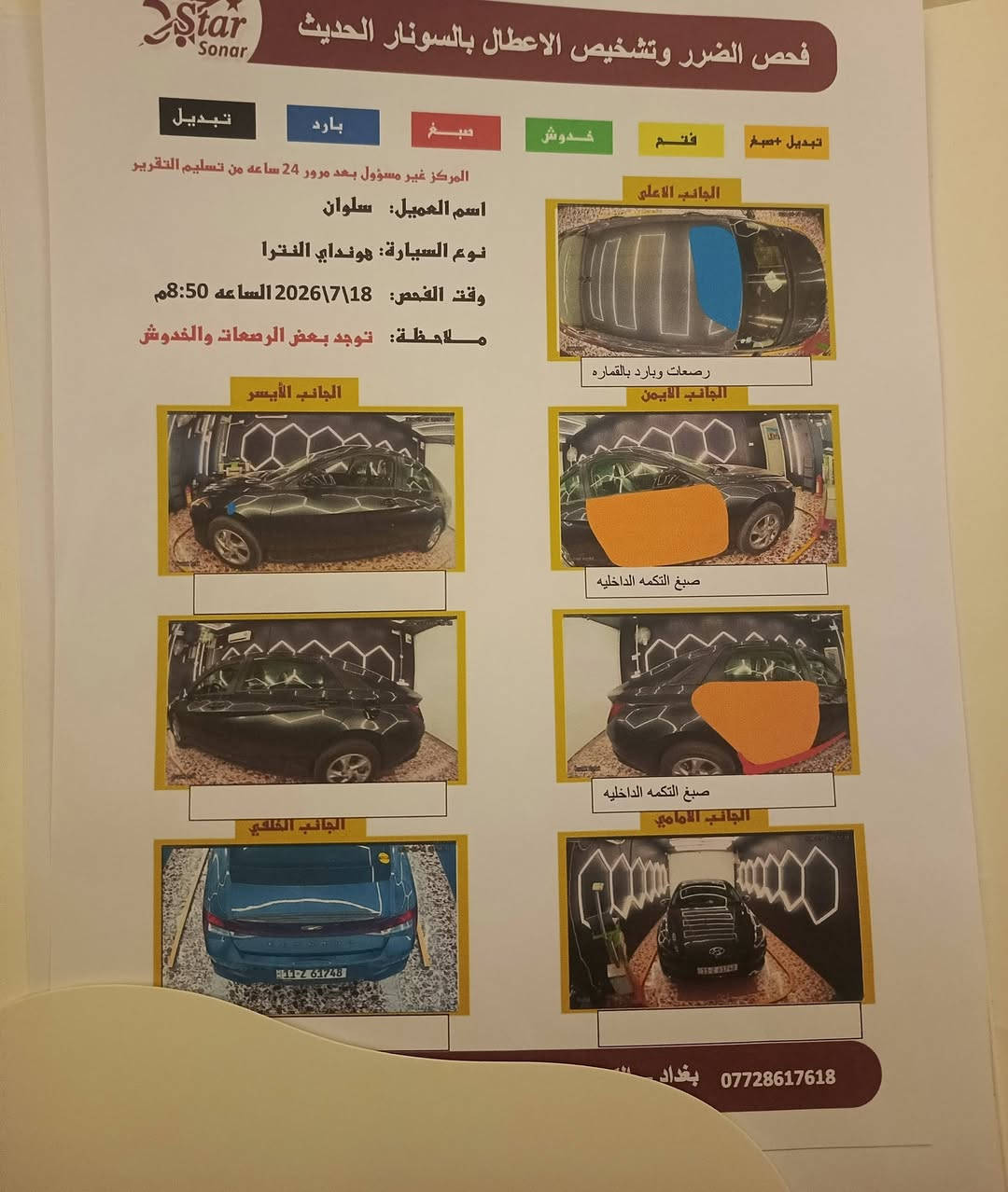 النترا ٢٠٢٣ امريكي
مكينة 2000 دوش
رادار امامي 

رادار خلفي 

رادار جانبي 

مود درايف ٣ وضعيات 

تبريد بيانو (مناخ منفصل)

تحكمات ستيرن جهتين 

تثبيت سرعه 

قيادة ذاتية

تحديد مسار 

مانع انزلاق 

السياره كلش حلوة ونصبتها حلوه 

ماشيه ٥٠ الف كيلو قابل للزياده 

السياره ماناقصها شي

القمارة بيهة بارد بدون صبغ سبب النقل 

ولبيبان تبديل

سعرها 140 وبيها مجال 

للاستفسار 

***********
