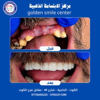 هوليود سمايل • فحص مجاني • الكوت الخاجية
