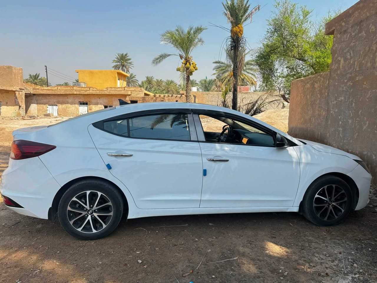 السلام عليكم النترا مديل 2019  خليجي ماشيه 100 الف مكفوله بس الي موضح بل صوره البنيد مفتوح بدون صبغ مثل مامئشر رصعات السياره محرك 2000 دوش ايتي السيارة جديده كامله من كلشي مكان السياره الخالص 145 السيارة بسمي 
***********

