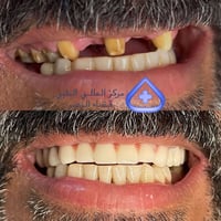 تجميل الاسنان • قضاء النصر • مركز طبي