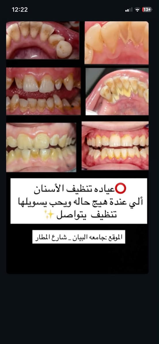 السلام عليكم للفائده
الي من بغداد ومحتاج قلع اسنان /تنظيف اسنان/حشوات ضوئيه /تعويضات اسنان وطقم كامل او جزئي / وايضا نشتغل اطفال كل الحالات 

يراسلني على الخاص او على الرقم *********** علما ان العلاج مجاني

نص مكتوب في الصور:
- عيادة الحشوات أستلم بيها هيج حالات العمل يكون مجاناً تحت إشراف اطباء اختصاص الموقع: جامعه البيان - شارع المطار
- عيادة (القلع) أستلم بيها هيج حالات والعمل يكون مجاناً وتحت إشراف أطباء أختصاص الموقع : جامعه البيان - شارع المطار
- عياده تنظيف الأسنان
- ألي عنده هيج حاله ويحب يسويلها تنظيف يتواصل
- الموقع : جامعه البيان _ شارع المطار