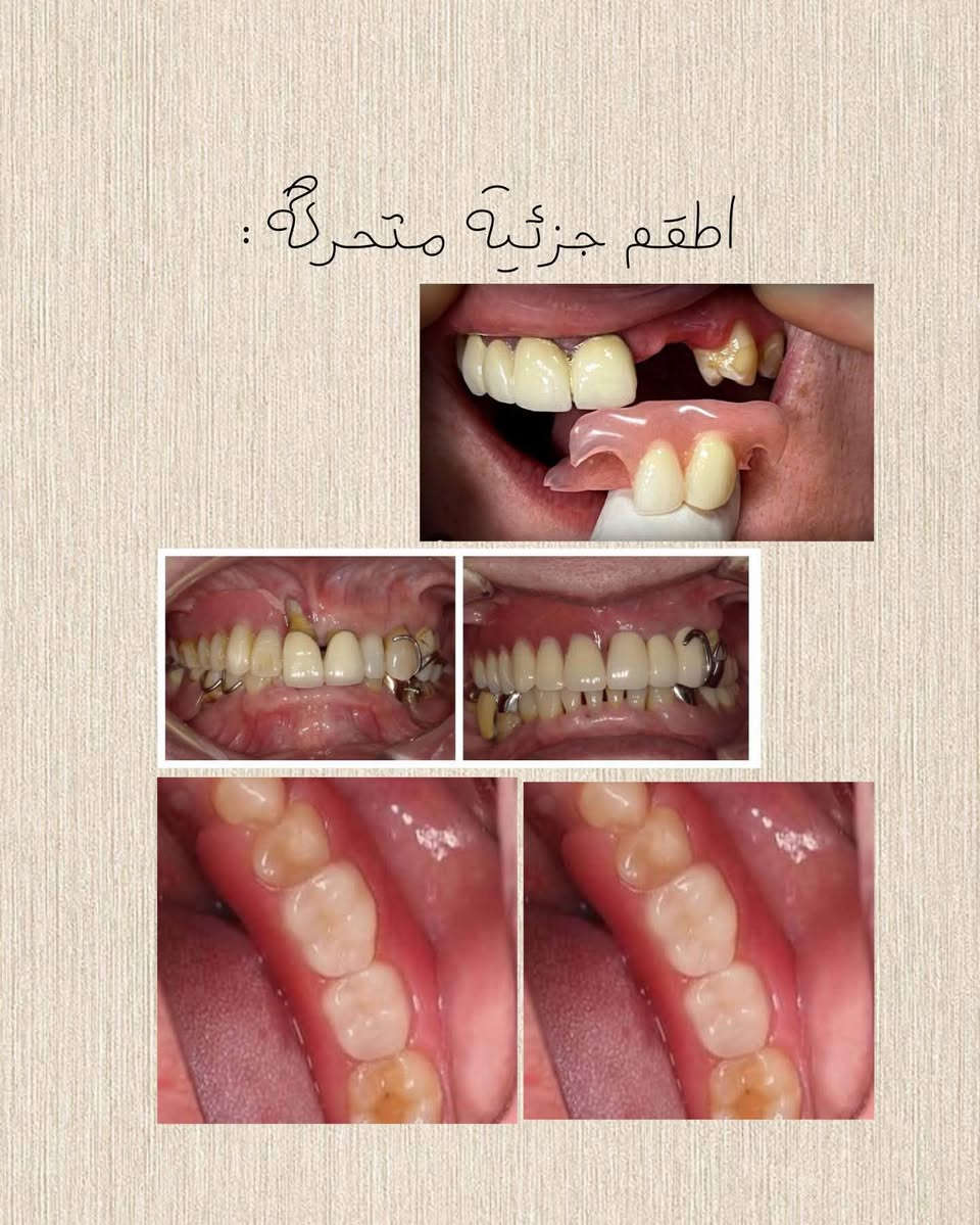 بغداد السيدية • علاج مجاني • تنظيف الاسنان