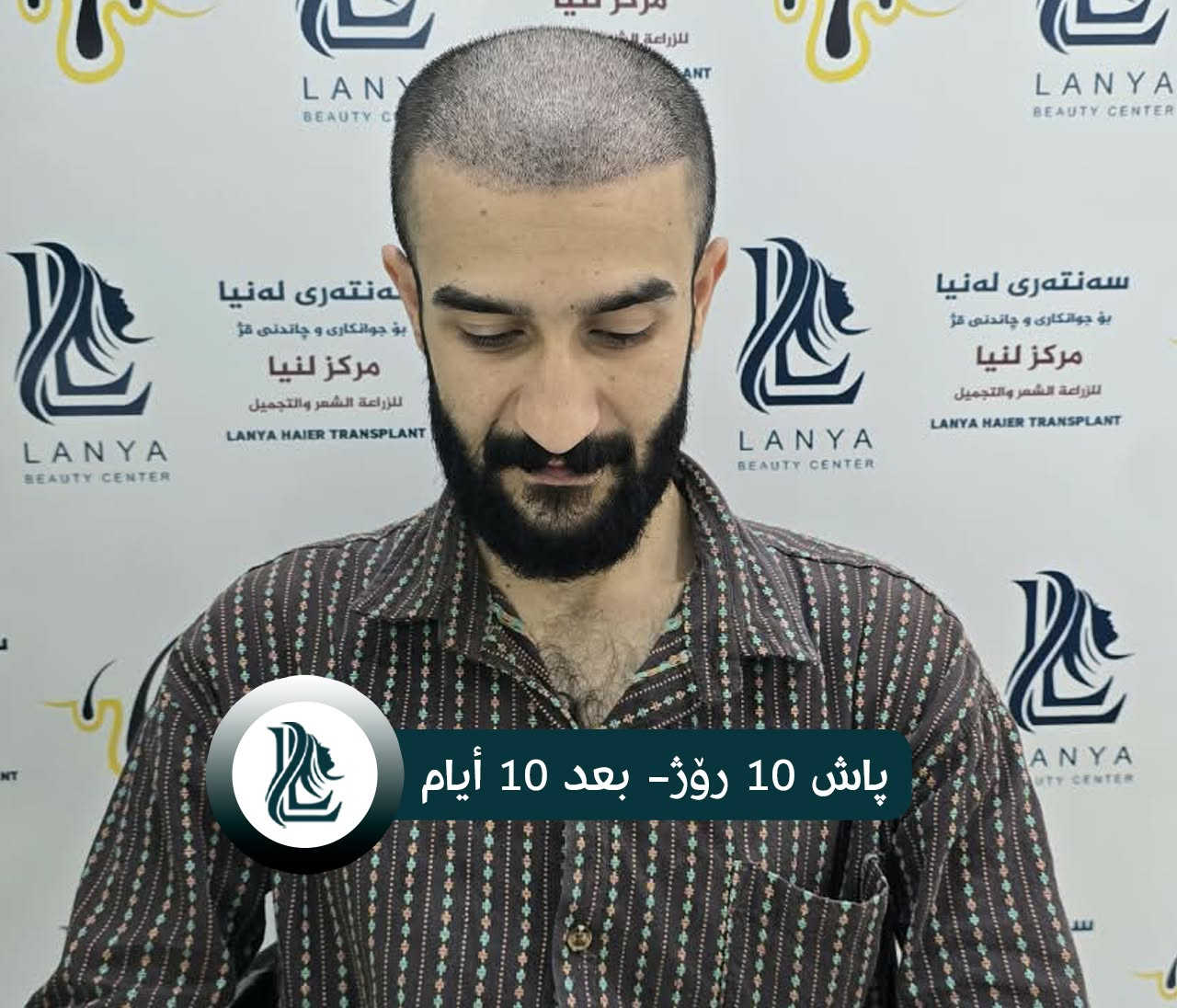 *ودّع فراغات الشعر، واستقبل إطلالة جديدة*
حلول متقدمة ونتائج تدوم.
♦ مع لەنیا حافظ على شبابك.
📍 العنوان:كلار - شارع ليوا - قرب جامع بخاري
📞 رقم التواصل:
***********
🔸🔸🔸🔸🔸🔸
چاندنی قژ لە لەنیا، هەنگاوێک بۆ دڵنیایی و جوانی زیاتر.
🔹 ئەنجامی چاندنەوەی قژی بێ وێنە و ناوازە هەموو کات لە سەنتەری لەنیا دەبینرێت
♦ لەگەڵ لەنیا هەمیشە بەگەنجی دەمێنێتەوە
📍 ناونیشان: کەلار- شەقامى لیواکە - نزیک مزگەوتی بوخاری
📞 ژمارەی پەیوەندی: ***********

