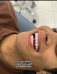 ابتسامه بدون برد • الامين شارع النواب • تجميل