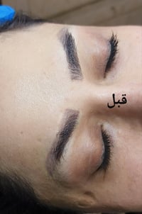 ازالة تاتو • تصليحات تاتو • السماوه الحسين