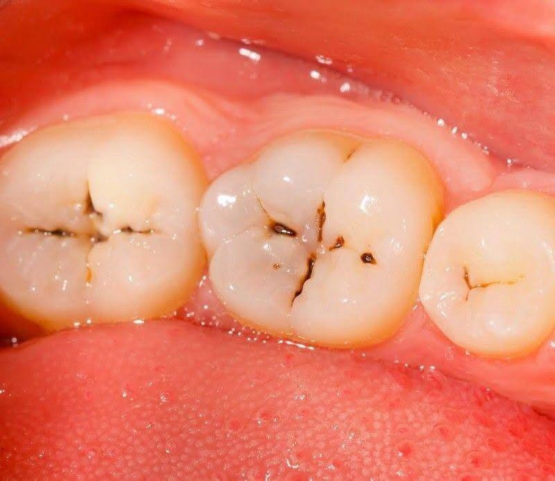 علاج مجاني • طقم متحرك • جامعة النور