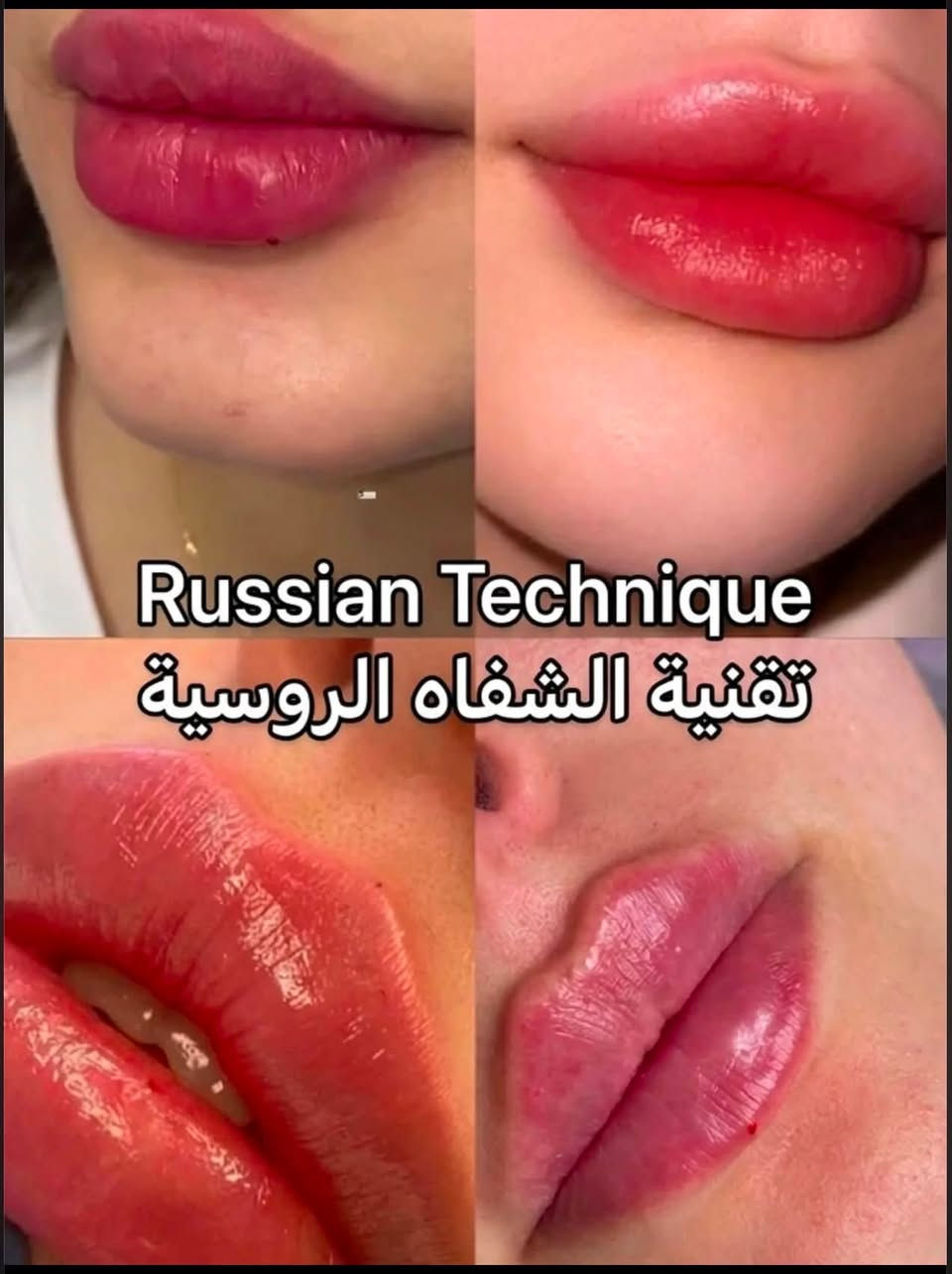عيادة الدكتور مصطفى خميس الجنابي
اخصائي الأمراض الجلدية والحساسية والتناسلية والتجميل والليزر 
الفلر -البوتوكس-ميزوثيرابي -خيوط ذهبية -ازالة الشعر بالليزر 

العنوان/الانبار -الفلوجة -شارع الاستخبارات -مجمع البلسم الطبي- مقابل البوابة الثالثة لمستشفى الفلوجة العام

للحجز/ 
***********.
***********
