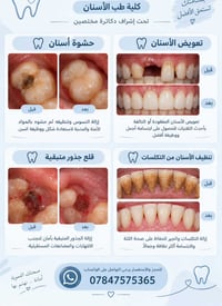 عيادة أسنان • جامعة المعارف • حشوات وتنظيف