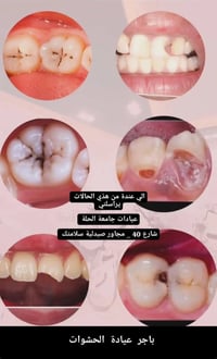 حشوات • عيادات جامعة الحلة • شارع ٤٠
