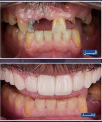 طب أسنان • تقسيط • ابتسامة