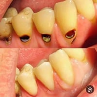 عيادات كلية طب الأسنان • قلع أسنان • تقويم أسنان