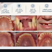 علاج مجاني • طقم أسنان • عيادات اليرموك