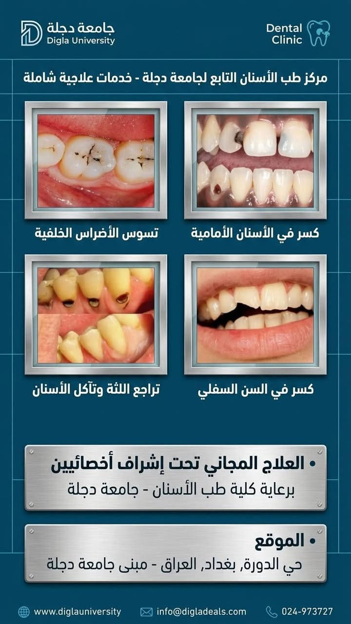 🦷 ابتسامتك وصحة أسنان عائلتك بأيدٍ أمينة… ومجاناً بالكامل ...

تحت إشراف نخبة من الأطباء والأخصائيين، يعلن فريق  طبي متخصص  من الكوادر النسائية في جامعة دجلة عن استقبال الحالات المرضية لتوفير الفحص والعلاج مجاناً بالكامل (100%) دون تحمل أي أجور للكشفية أو المواد أو العمل العلاجي.

✨ علاج مجاني بالكامل | أجهزة حديثة | إشراف طبي متخصص | عناية وتعقيم بأعلى المستويات

ويتم تقديم العلاج تحت إشراف مباشر من طبيبات أخصائيات، حرصاً على الدقة وجودة العمل وسلامة المراجعين.

👧 عيادة الأطفال | من عمر 4 إلى 11 سنة

تشمل الخدمات:
• علاج تسوس الأسنان وحشوات الأسنان اللبنية.
• قلع الأسنان التالفة أو المتحركة بعناية وحرص.
• تنظيف الأسنان.
• سد الفجوات للمساعدة في حماية أسنان الطفل من التسوس.

👩 عيادة النساء | جميع الأعمار

تشمل الخدمات:
• الحشوات التجميلية والحشوات الاعتيادية.
• تنظيف الأسنان وإزالة التكلسات والتصبغات.
• تعويض الأسنان المفقودة من خلال أطقم الأسنان والجسور.

👴 عيادة كبار السن | من عمر 60 سنة فما فوق

• صناعة وتعويض أطقم الأسنان الكاملة والجزئية للفك العلوي والسفلي.
• المساعدة على استعادة القدرة على المضغ وتحسين وظيفة وشكل الأسنان.

📍 الموقع:
بغداد – الدورة – شارع المصافي – جامعة دجلة الأهلية

💰 التكلفة:
مجــانــاً 100%
دون أي رسوم للكشفية أو المواد أو العمل العلاجي.

🩺 خصوصيتك وسلامتك أولويتنا
كادر طبي نسائي، مع الالتزام بأعلى معايير التعقيم والعناية أثناء تقديم الخدمات العلاجية.

📩 للحجز والاستفسار:
يرجى إرسال رسالة خاصة لغرض الفرز وتحديد الأولوية، أو التواصل عبر الواتساب:
📞  ***********

✨ لا تؤجل علاج أسنانك… ولا تحرم طفلك من ابتسامة صحية.
احجز الآن واستفد من العلاج المجاني بالكامل في العيادات التعليمية بجامعة دجلة الأهلية.

نص مكتوب في الصور:
- عناية بابتسامات أطفالنا
- صحة أسنان طفلك، أمان وثقة.
- وكل مشاكل اسنان الاطفال 💙
- بغداد/الدورة/ شارع المصافي/جامعه دجلة 📍
- للحجز والاستفسار: 📷 📞 ***********
- جامعة دجلة Digla University Dental Clinic مركز طب الأسنان التابع لجامعة دجلة - خدمات علاجية شاملة تسوس الأضراس الخلفية كسر في الأسنان الأمامية تراجع اللثة وتآكل الأسنان كسر في السن السفلي • العلاج المجاني تحت إشراف أخصائيين برعاية كلية طب الأسنان - جامعة دجلة • الموقع حي الدورة, بغداد, العراق - مبنى جامعة دجلة www.diglauniversity info@digladeals.com 024-973727
- عيادة تنظيف الاسنان
- ازالة التكلسات والتصبغات
- العلاج مجانًا تحت إشراف اطباء مختصين
- الموقع: الدورة _جامعة دجلة
- طقم الأسنان المتحرك
- حل احترافي لتعويض الأسنان
- تعويض الأسنان المفقودة من خلال طقم الأسنان المتحرك
- حلول عملية ومريحة لاستعادة ابتسامتك
- العنوان: بغداد - الدورة - شارع المصافي
- عيادة جامعة دجلة
- للحجز: + ***********
- الخطة العلاجية المقترحة العلاج مجاناً تحت اشراف اطباء مختصين قلع الاسنان التالفة وبقايا جذور الدورة_جامعة دجلة للتواصل والحجز: *********** @generic جامعة دجلة Al-Dajla University