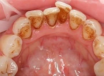 السلام عليكم
🦷🦷متوفر 
⭕️حشوات تجميلية 
 ⭕️تنظيف اسنان 
⭕️قلع الاسنان والجذور المتبقية 
⭕️طقم اسنان جزئي 
❗️العلاج تحت إشراف اطباء اختصاص 
📍العنوان : الدورة / ابو دشير / جامعة كلكامش
 
📞 واتساب :
 ***********
