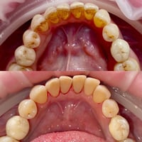 🌸🤍 متوفر استقبال مراجعين لعلاج الاسنان ضمن العيادات التعليمية، وبإشراف...