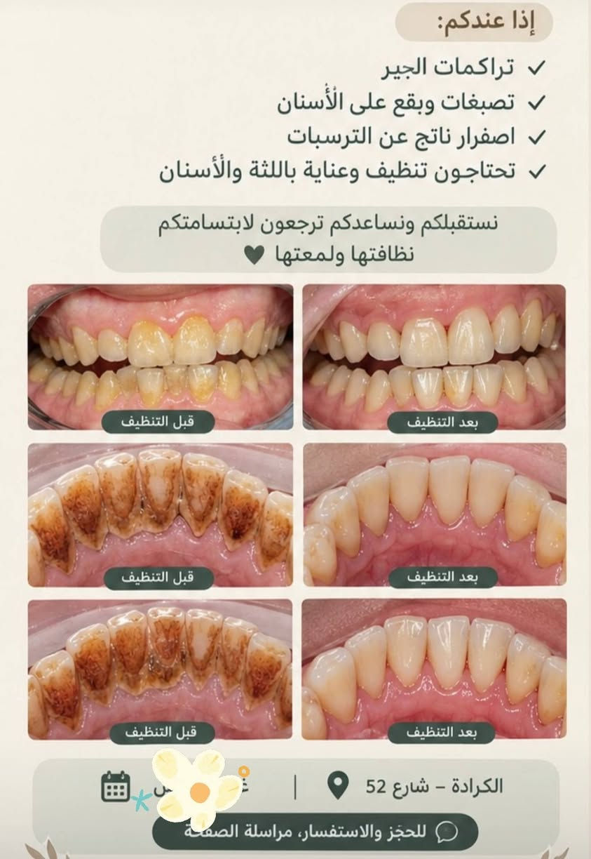 علاج أسنان مجاني • الكرادة شارع ٥٢ • أسنان أطفال