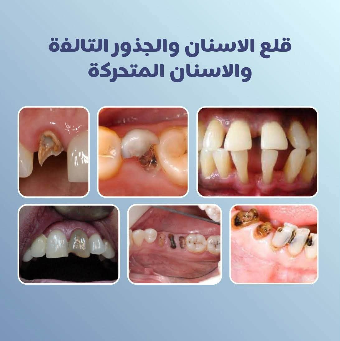 علاج مجاني • تقويم أطفال • جامعة ابن سينا
